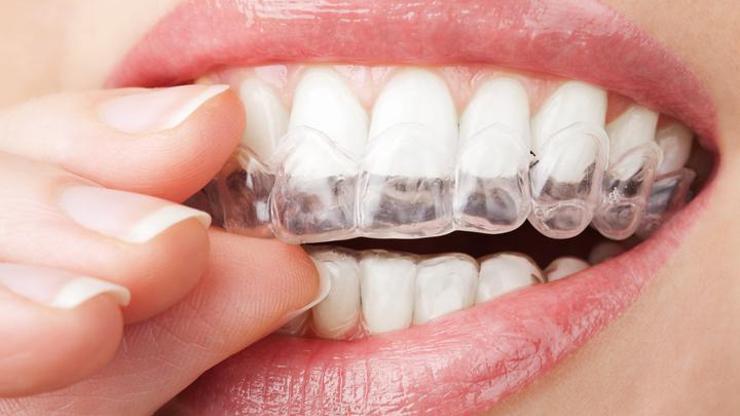 Diş eksikliği bunama sebebi olabilir