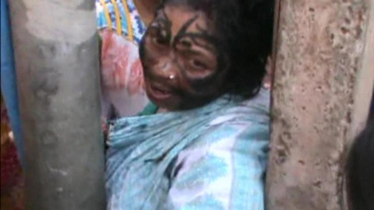 Hindistanda büyücü olduğu gerekçesiyle bir kadını dövdüler