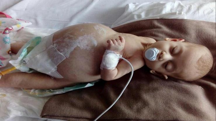 Miray bebek ölmesin, ailesi yardım bekliyor