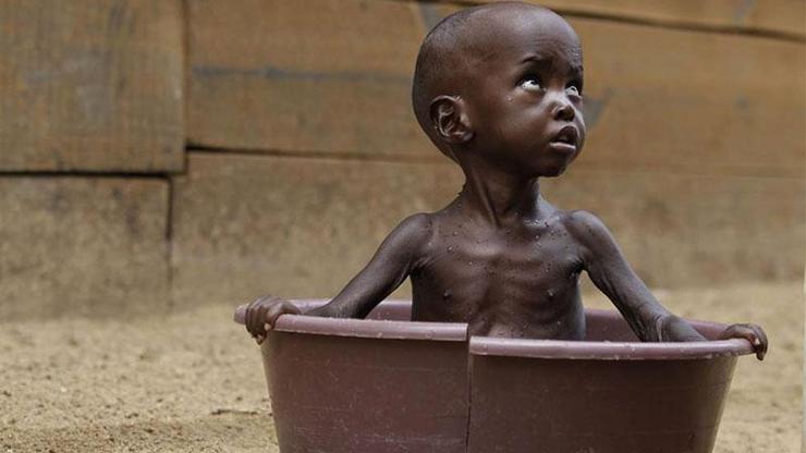 UNICEF: Nijeryada çocuklar kıtlık tehlikesinde