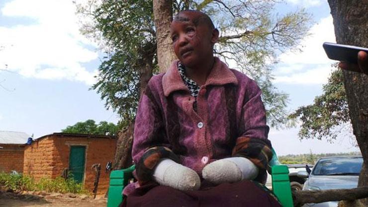 Hamile kalamıyor bahanesiyle karısının ellerini kesti