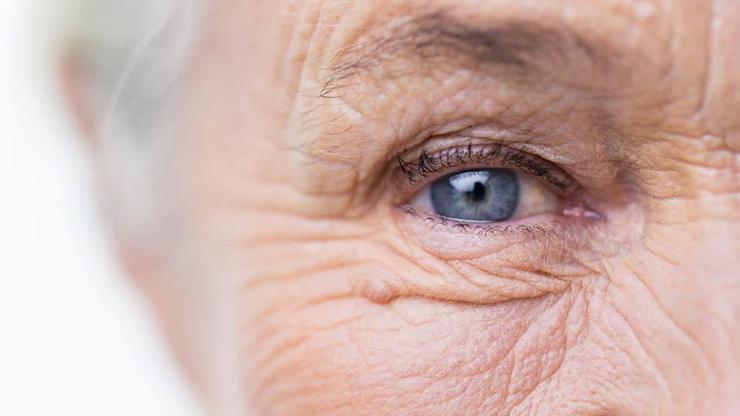Hareketli göz protezi nedir, ameliyat süreci nasıl seyreder