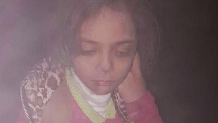 7 yaşındaki Halepli Alabed: Evim yok, açım, ölmek istemiyorum; sesimi duyun