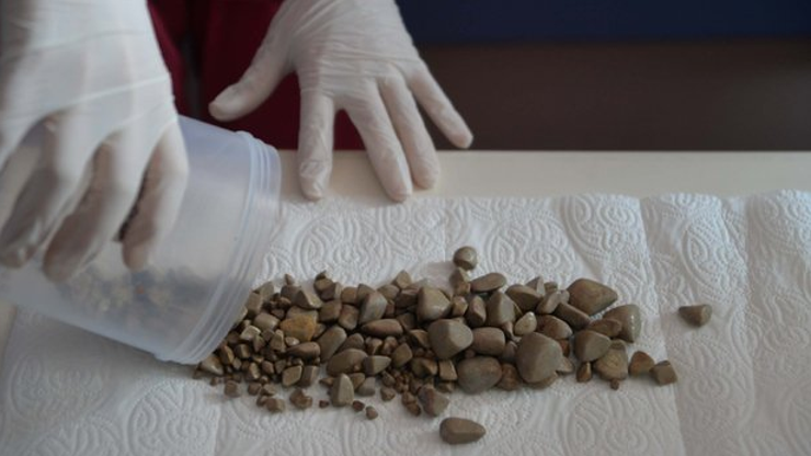 Mesanesinden 1000den fazla taş çıktı