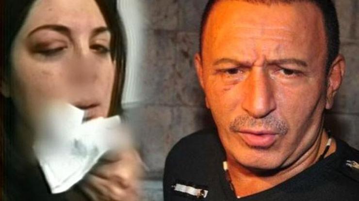 Mustafa Topaloğlu, 18 yıllık eşi Derya Topaloğlu’nu hastanelik etti