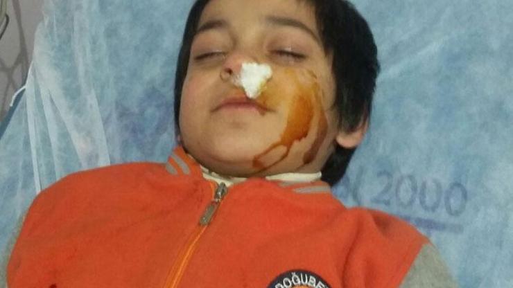 Oğluyla kavga eden 9 yaşındaki çocuğu dövdü