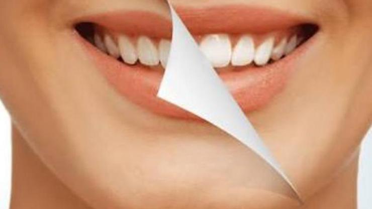 Diş beyazlatmak zararlı mı