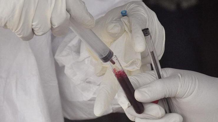 Ebola virüsü hastalığı atlatanların sperminde iki yıl daha yaşıyor
