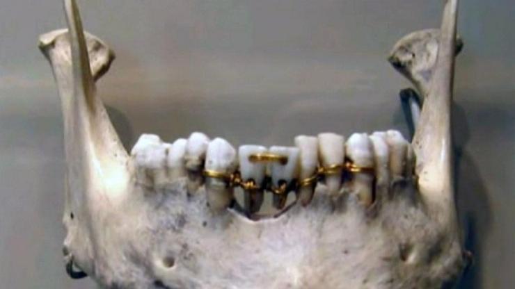 Dişçilik tarihinin bilinmeyenleri