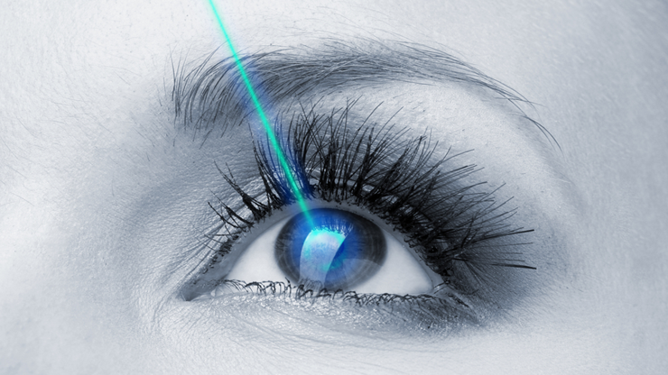 Lazerle miyop, hipermetrop ve astigmat tedavisi kimlere uygulanır