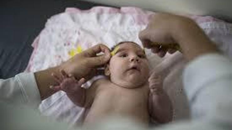 Fransa: Valproat 4 bin 100 kusurlu doğuma yol açmış olabilir