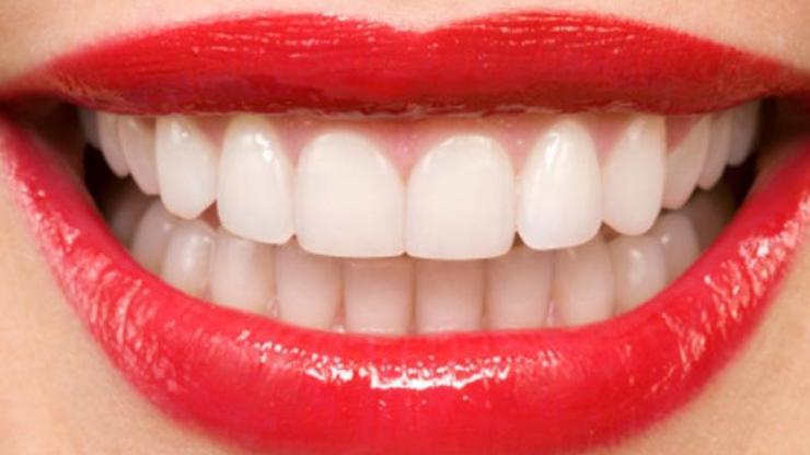 Diş beyazlatma zararlı mı
