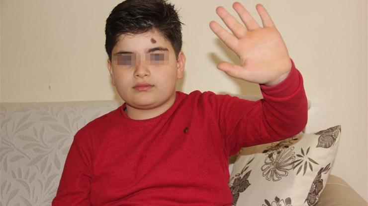 İnsanlıktan çıkan magandalar bacakları olmayan 10 yaşındaki çocuğu dövdü