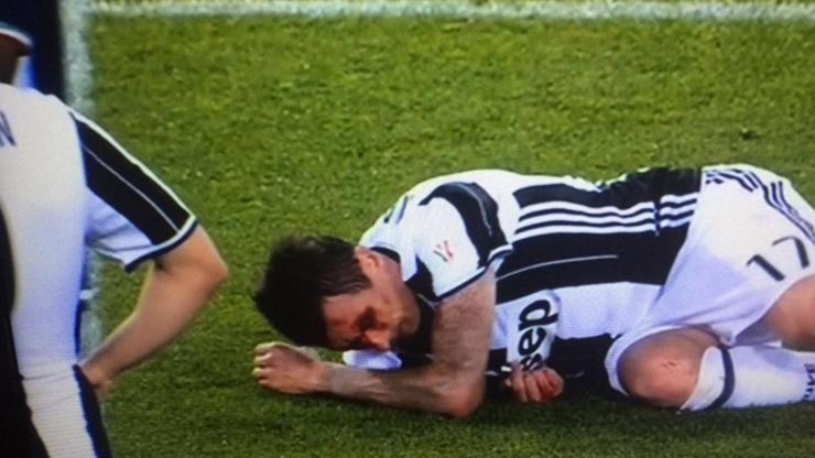 Mandzukic kanlar içinde kaldı