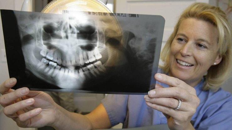 Yıllardır burnu tıkalı kadının ameliyatında şok: Burnunun içinde diş çıktı