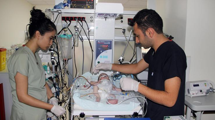 Suriyeli bebeğin kalbinin yarısı çalışmıyor