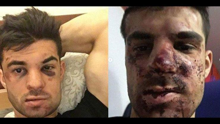 Rus futbolcu Terentyevi otomobilinde dövdüler
