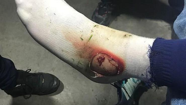 Fenerbahçe Hasan Ali Kaldırım’ın ayağının fotoğrafını paylaştı