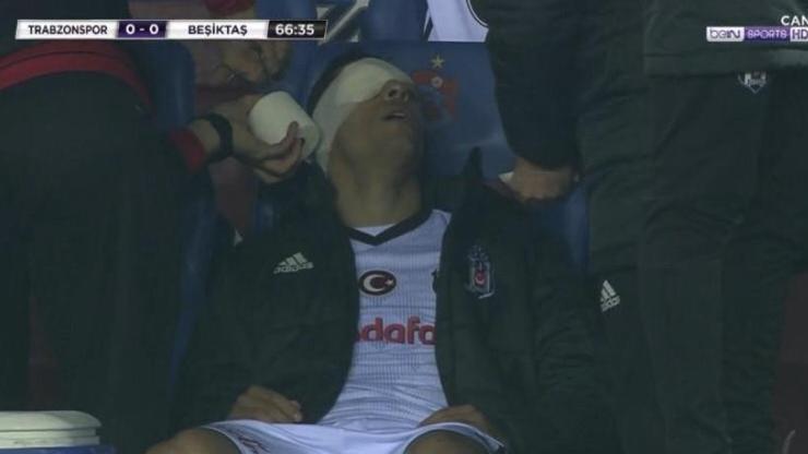 Adrianonun gözü sarıldı