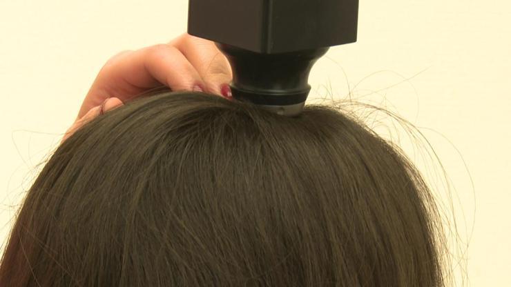 Saç dökülmesine yeni ve kolay çözüm: Saç lazeri