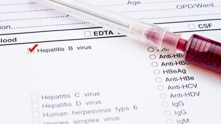 Hepatit B araştırması korkunç gerçeği gözler önüne serdi