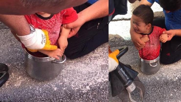 2 yaşındaki Ahmet Muhammed, düdüklü tencereye sıkıştı