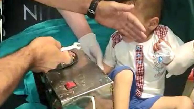 3 yaşındaki çocuğun eli kıyma makinesine sıkıştı
