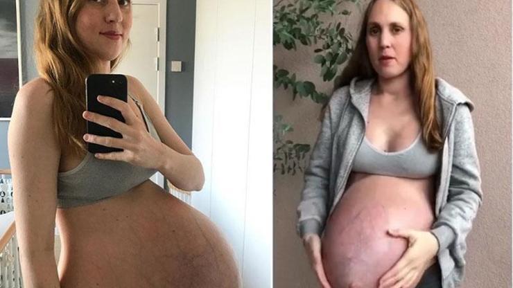 Üçüzlere hamile kadın, paylaşımlarıyla sosyal medyayı salladı