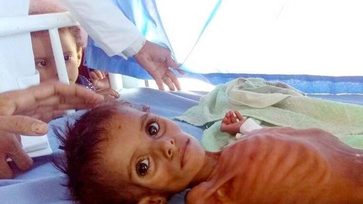 BM korkunç raporu açıkladı: Her 1 dakikada 12 çocuk can veriyor