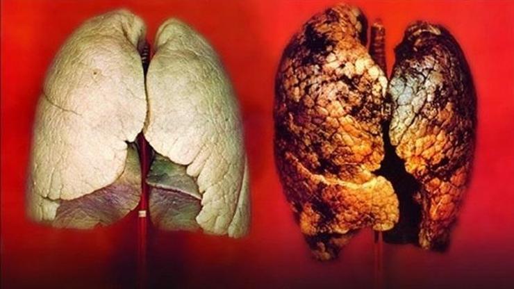 Sigara içiyorsanız... Kanser riski 36 kat artıyor