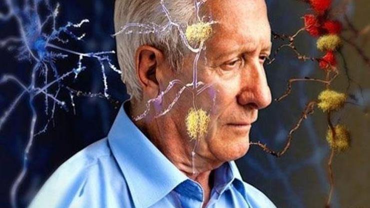 Alzheimerı önlemenin yolları