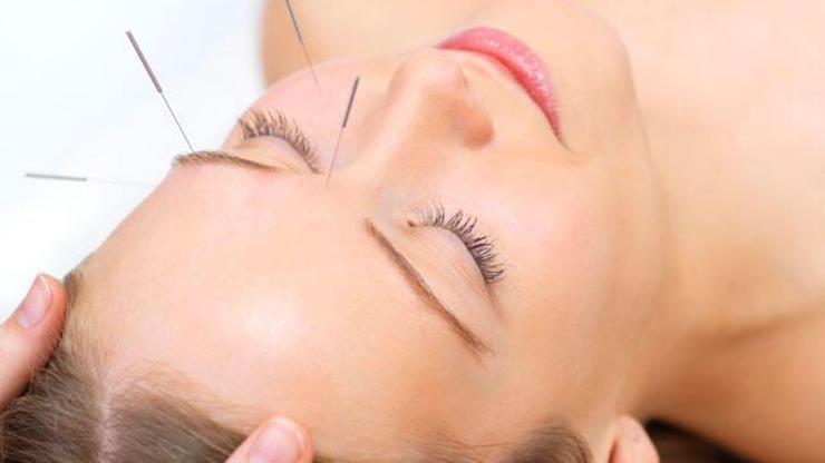 Kadın hastalıklarında akupunktur tedavisi