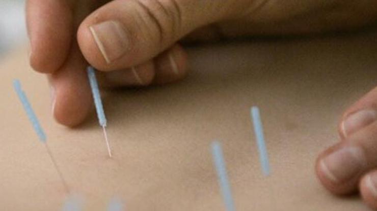 Kadın hastalıklarında lazer akupunktur tedavisi