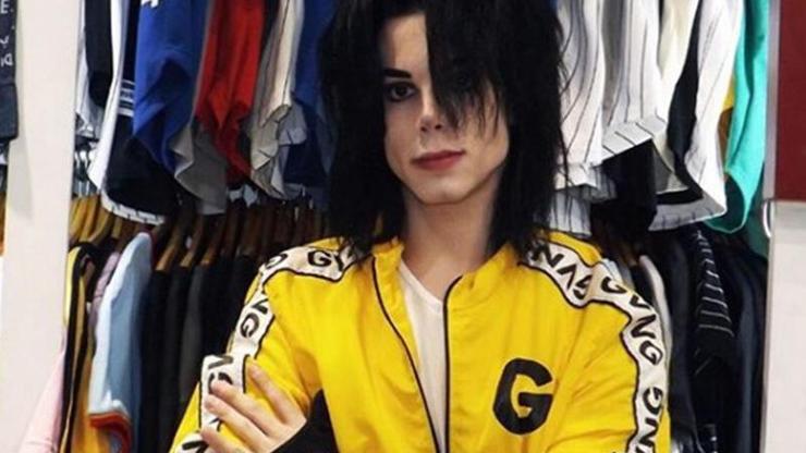 Michael Jacksona benzemek istedi bu hale geldi Eski halini görenler ise inanamıyor
