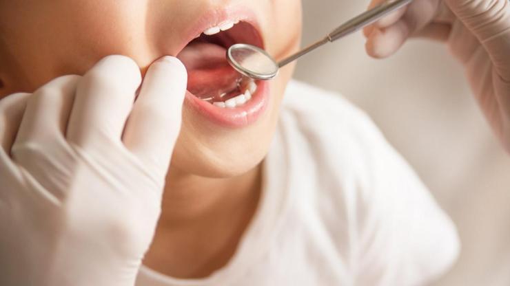 Biberon çürüğü çocukların diş sağlığını olumsuz etkiliyor