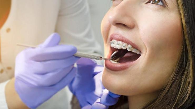 Yetişkinlerde ortodontik tedaviler ve şeffaf plaklar