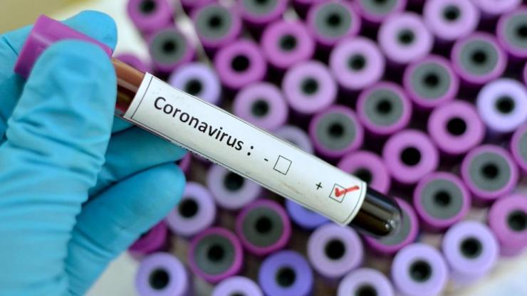 Corona virüsü aşısı bulundu mu İşte Corona aşısında son durum