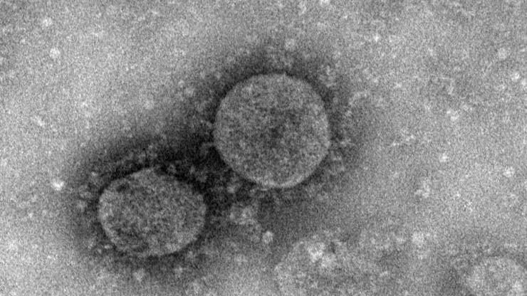 Koronavirüs 2019 sonbaharda yayılmaya başlamış