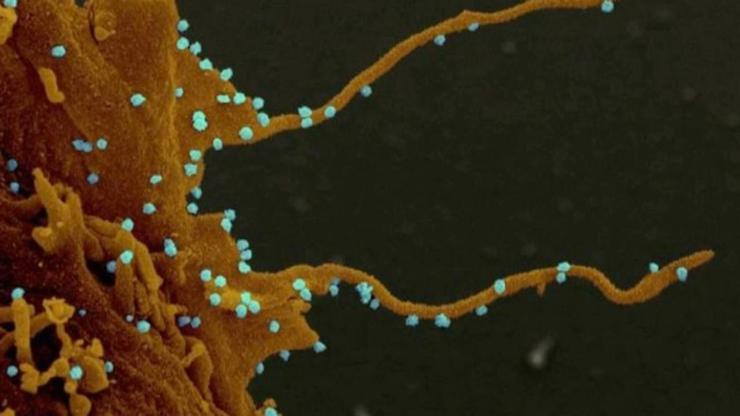 Son dakika: Bilim insanları koronavirüsün kollarını görüntüledi | Video