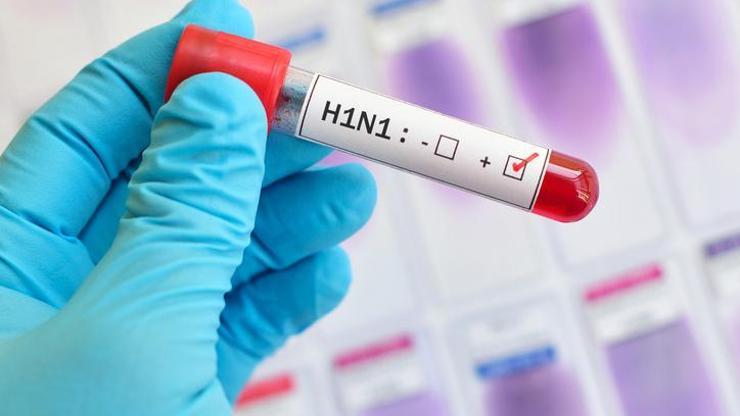 Çin’de yeni virüs paniği: G4 H1N1 domuz gribi nedir Pandemik potansiyele sahip