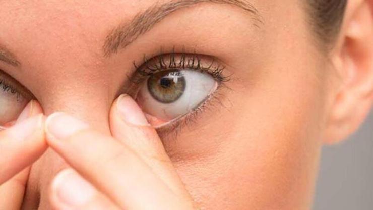 Kadınlarda en sık görülen göz hastalıkları