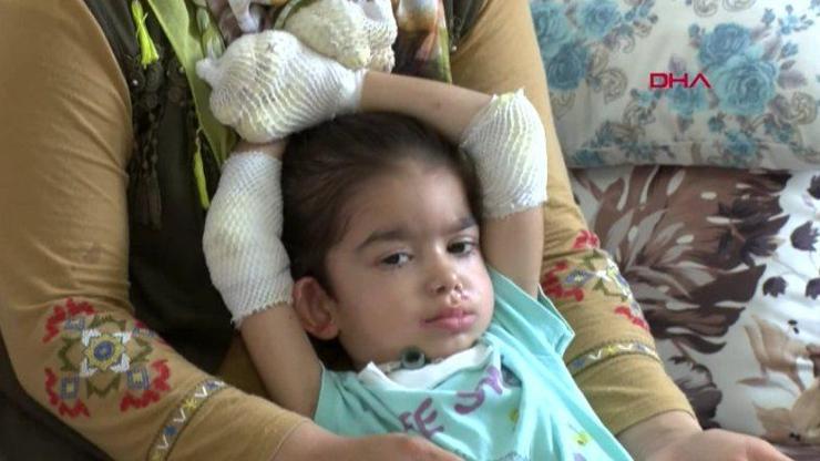 Adanada Kelebek hastası Büşra yardım bekliyor | Video