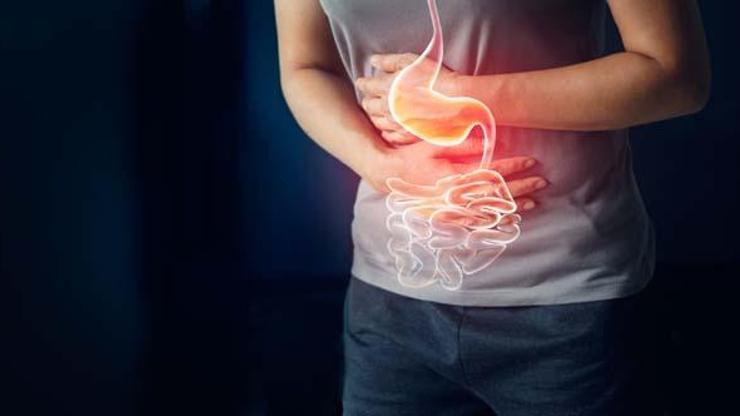 Crohn Hastalığı Nedir Crohn Hastalığı Belirtileri Neler, Nasıl Tedavi Edilir
