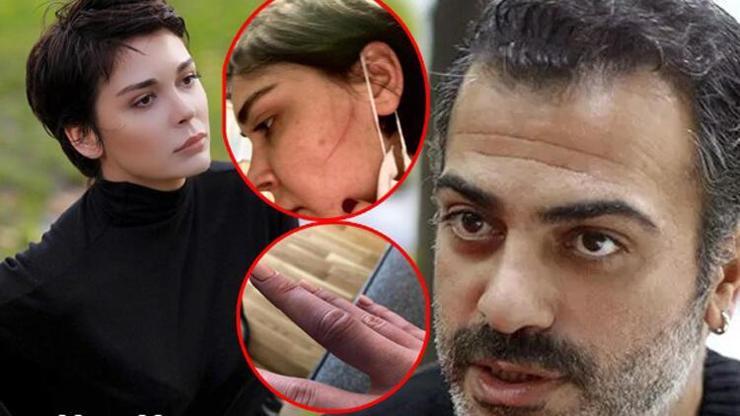 Son dakika  Sevcan Yaşar: Sermiyan Midyat dövüp çıplak videomu çekti
