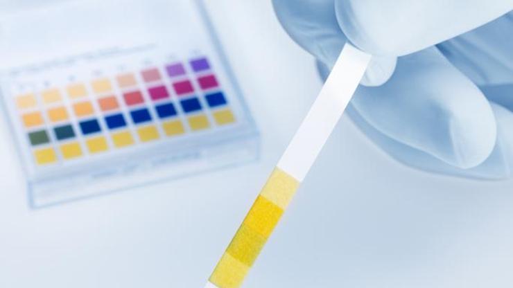 İdrarda Protein Kaçağı Nedir, Neden Olur? Protein Kaçağının Zararları Nelerdir?