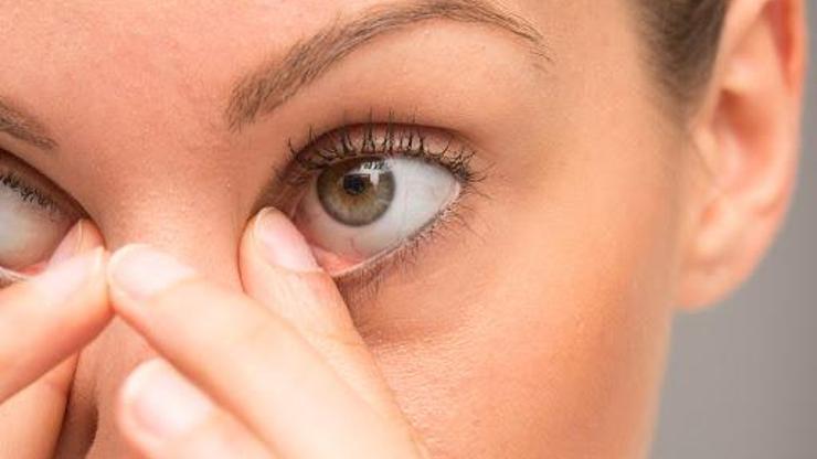 Göz Bebeği Hastalıkları Nelerdir Anizokori Ve Eşit Büyüklükte Olmayan Göz Bebekleri Nasıl Geçer