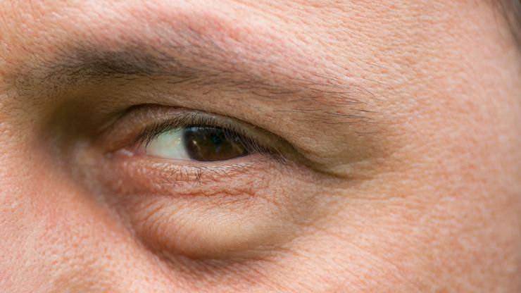 50 yaş üzerindeki kişilere önemli uyarı: Gözlerdeki bu belirtileri ihmal etmeyin