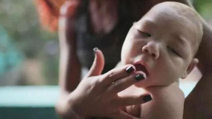 Hindistan’da 14 kişide Zika virüsü tespit edildi