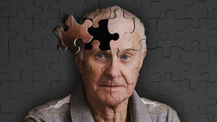 Alzheimer Nedir, Neden Olur Alzheimer Belirtileri Nelerdir, Tedavisi Nasıl Yapılır