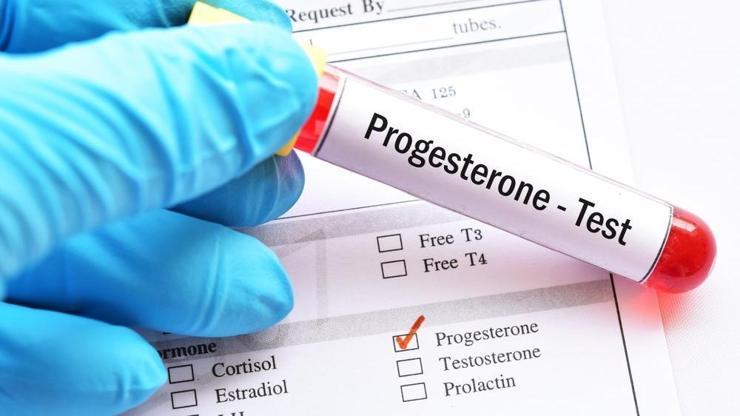 Progesteron Hormonu Nedir, Ne İşe Yarar Progesteron Hormonu Değeri Kaç Olmalıdır